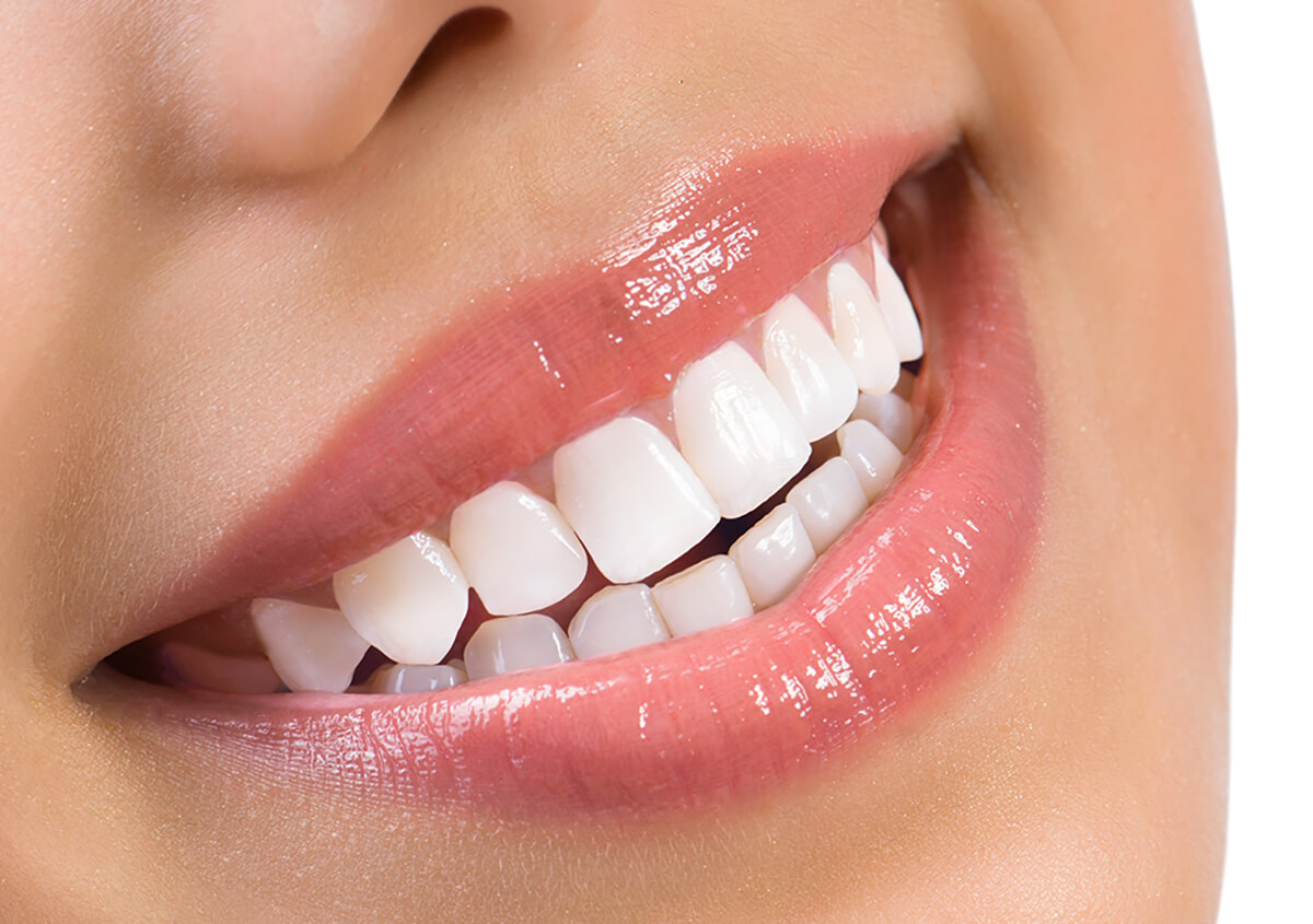 Will Professional Teeth Whitening Brighten Your Smile?