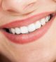Popular Questions Asked by Patients Looking for Dental Teeth Whitening Options in Walnut Creek, CA
